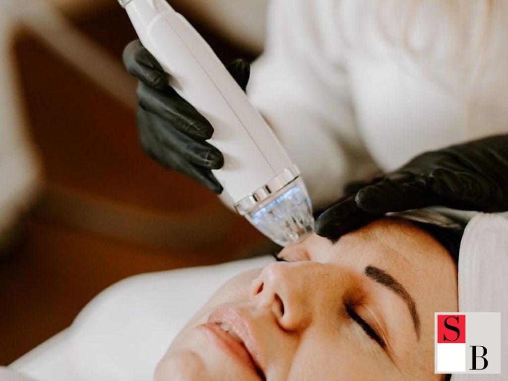 Why Gold RF Microneedling Is Ideal for Singapore’s Skin Needs
