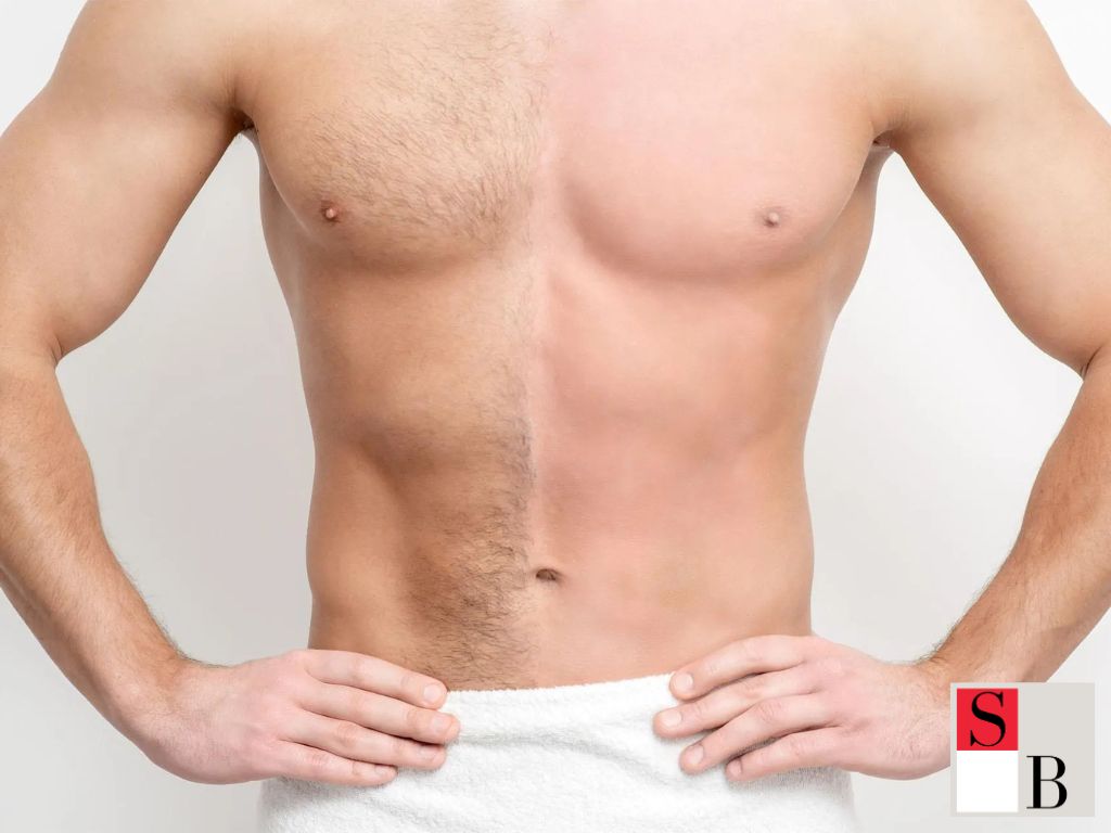 Understanding Hair Removal for Men in Singapore