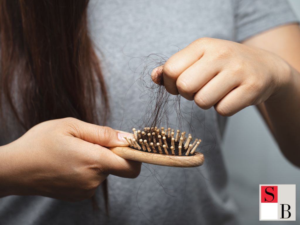 What Causes Alopecia in Singaporean Women?