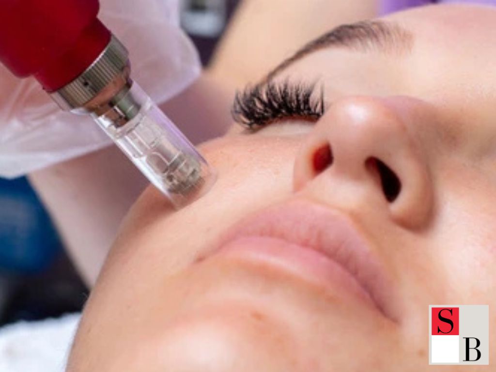 Trusted Microneedling Solutions at Wellaholic Upper Changi