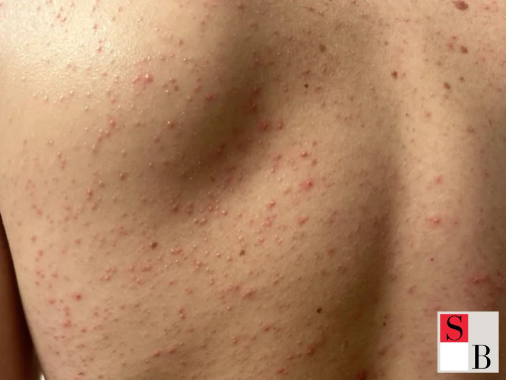 Choosing the Right Hair Removal Method for Your Skin and Lifestyle