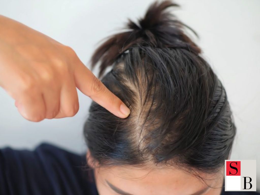 Why Hair Loss Happens to Asian Women: Understanding the Core Causes of Hair Thinning