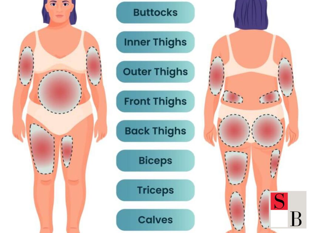 Benefits of Body Contouring Treatments in Singapore’s Climate
