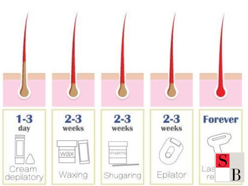 Making Hair Removal Results Last Longer in Singapore