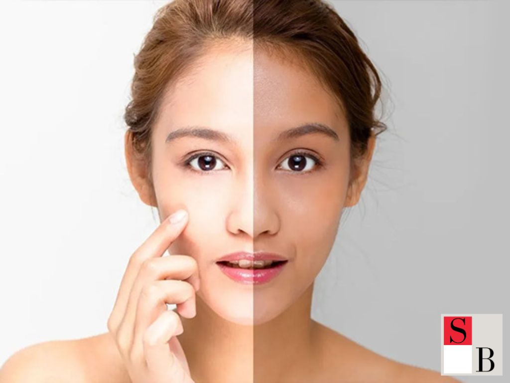 Quick Solutions for a Brighter Complexion