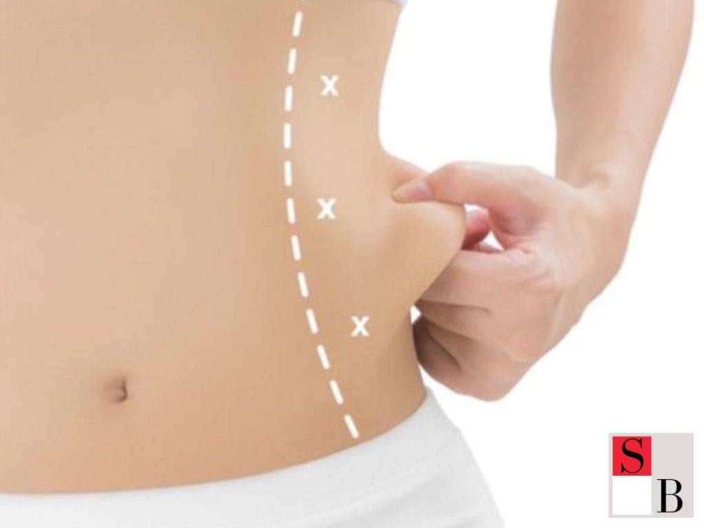 What Is Body Contouring and Why It’s Trending in Singapore