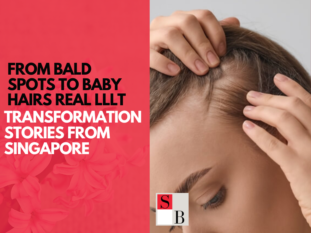 From Bald Spots to Baby Hairs Real LLLT Transformation Stories from Singapore