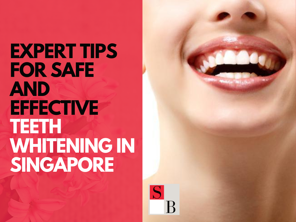 Expert Tips for Safe and Effective Teeth Whitening in Singapore