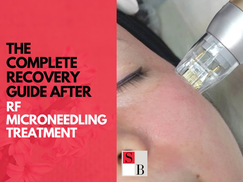 The Complete Recovery Guide After RF Microneedling Treatment