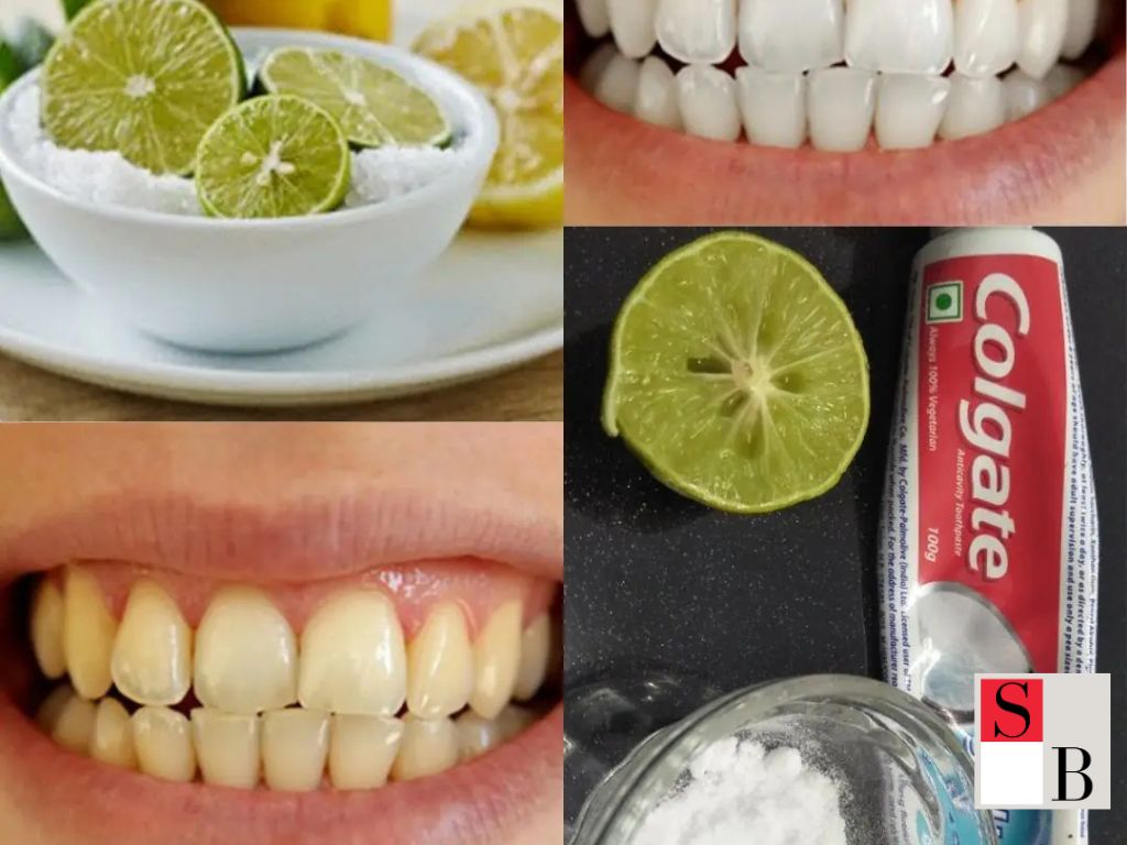 How to Whiten Teeth at Home in Singapore