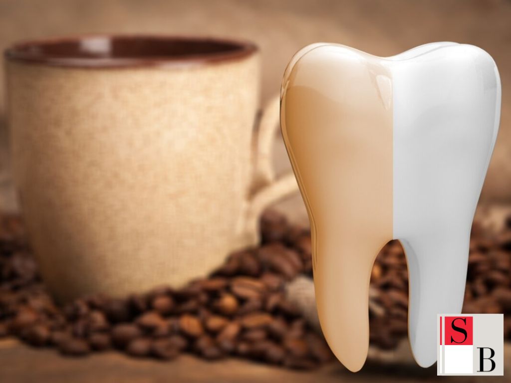 What Teeth Whitening Really Means for Singaporean Women