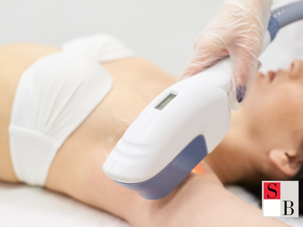 Benefits of SHR Hair Removal for Singapore Skin and Lifestyles