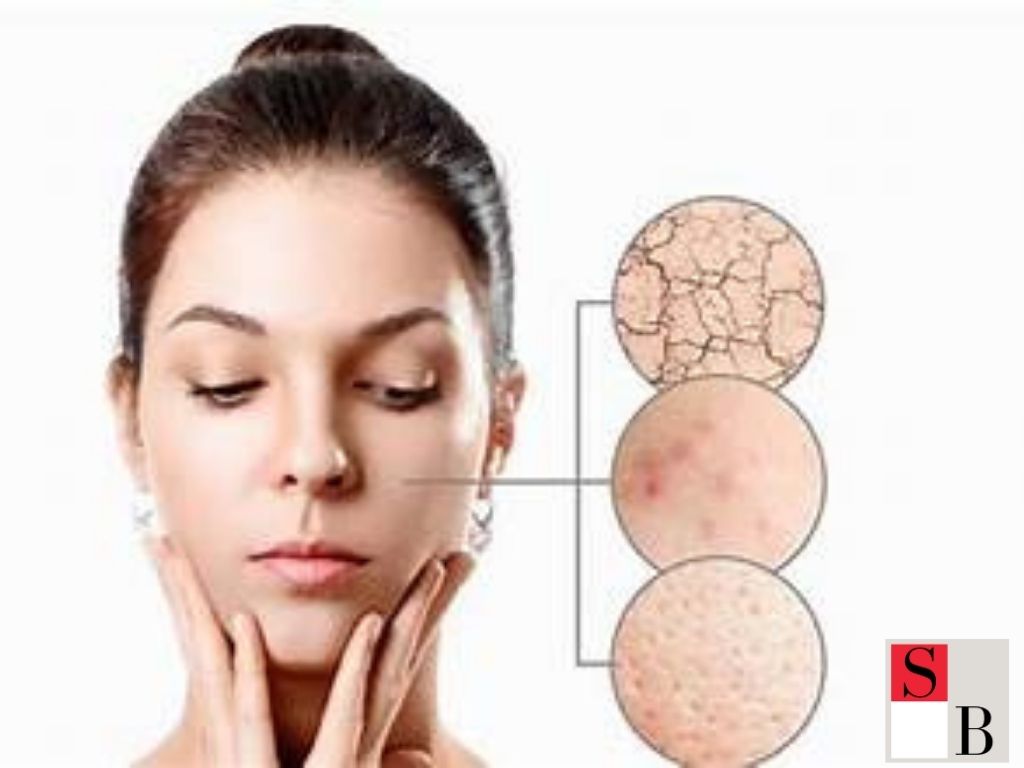How to Hydrate Your Skin Effectively in Singapore