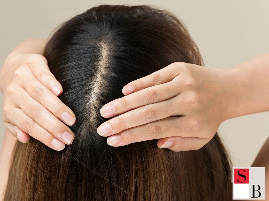 Benefits of Addressing Hair Thinning Early in Singapore