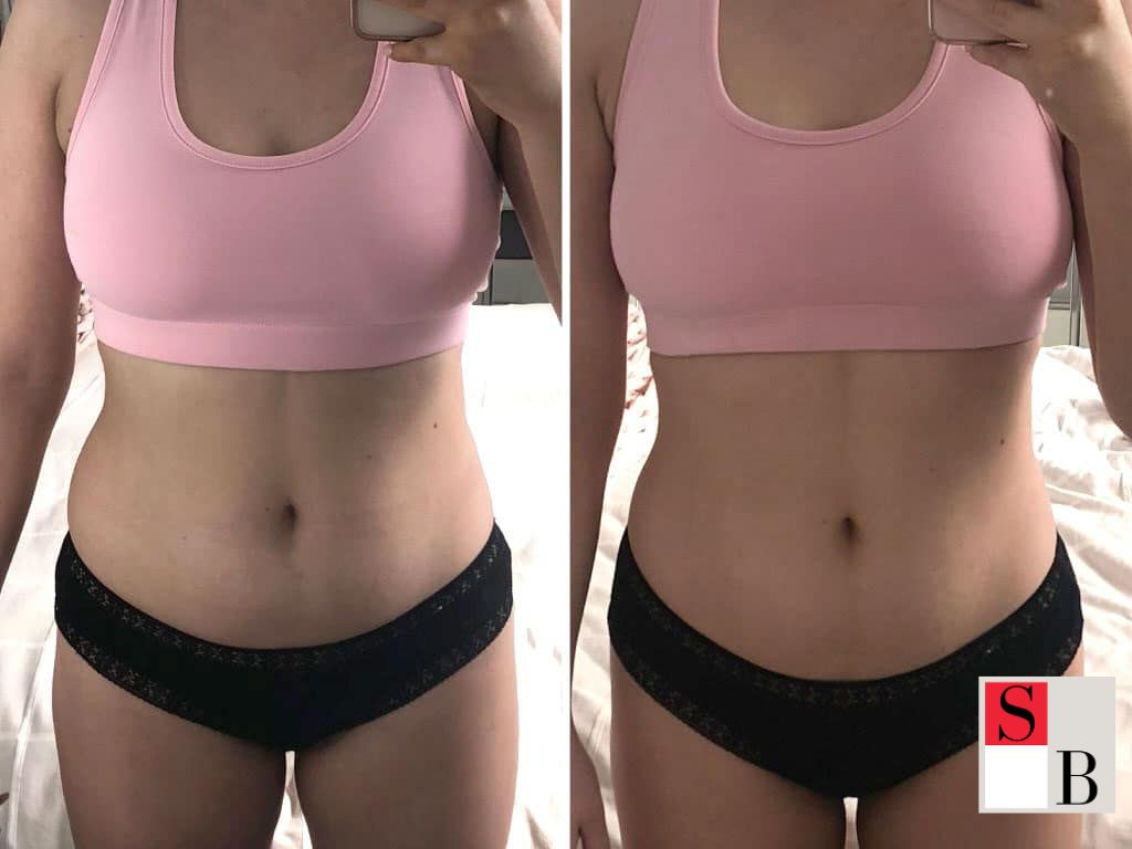 Key Benefits of Fat Freezing for Busy Singapore Professionals
