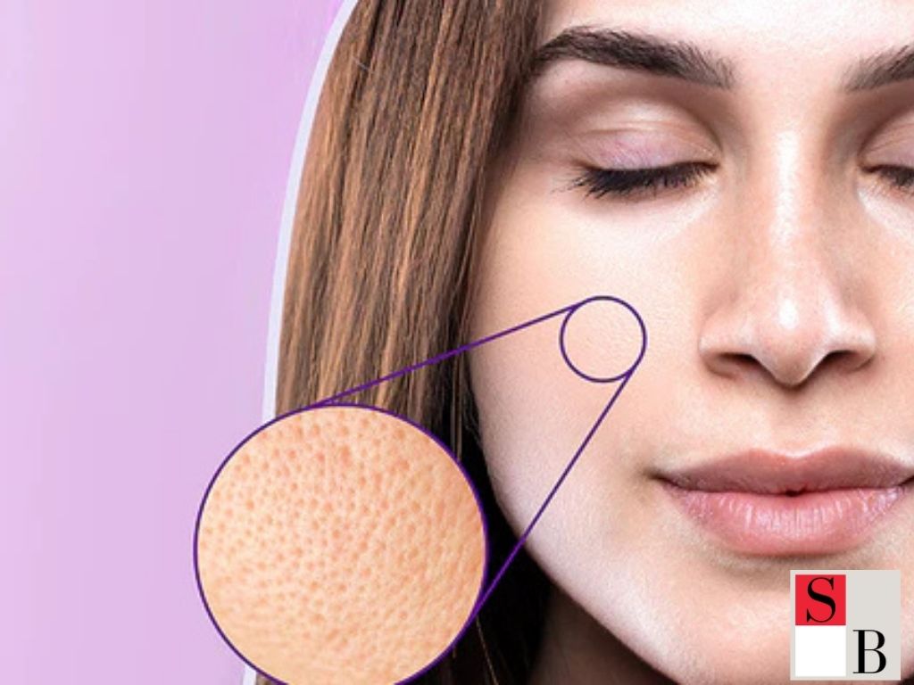 Benefits of RF Microneedling for Singapore Skin