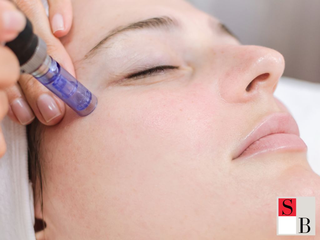 Implementation Strategies for Microneedling and Chemical Peels in Singapore