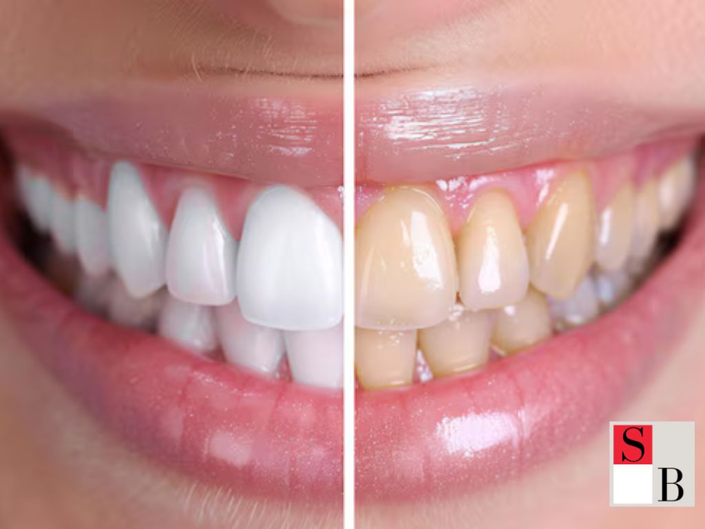 What Makes a Radiant Smile in Singapore?