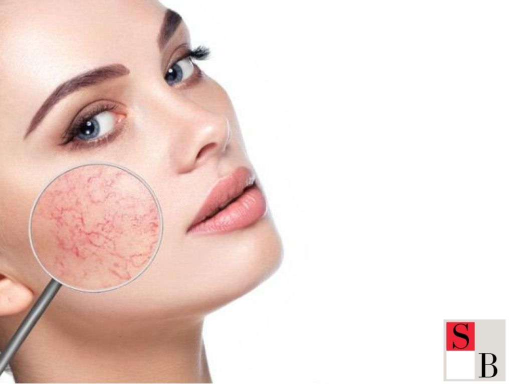 Why Your Moisturizer Isn’t Moisturizing in Singapore’s Climate