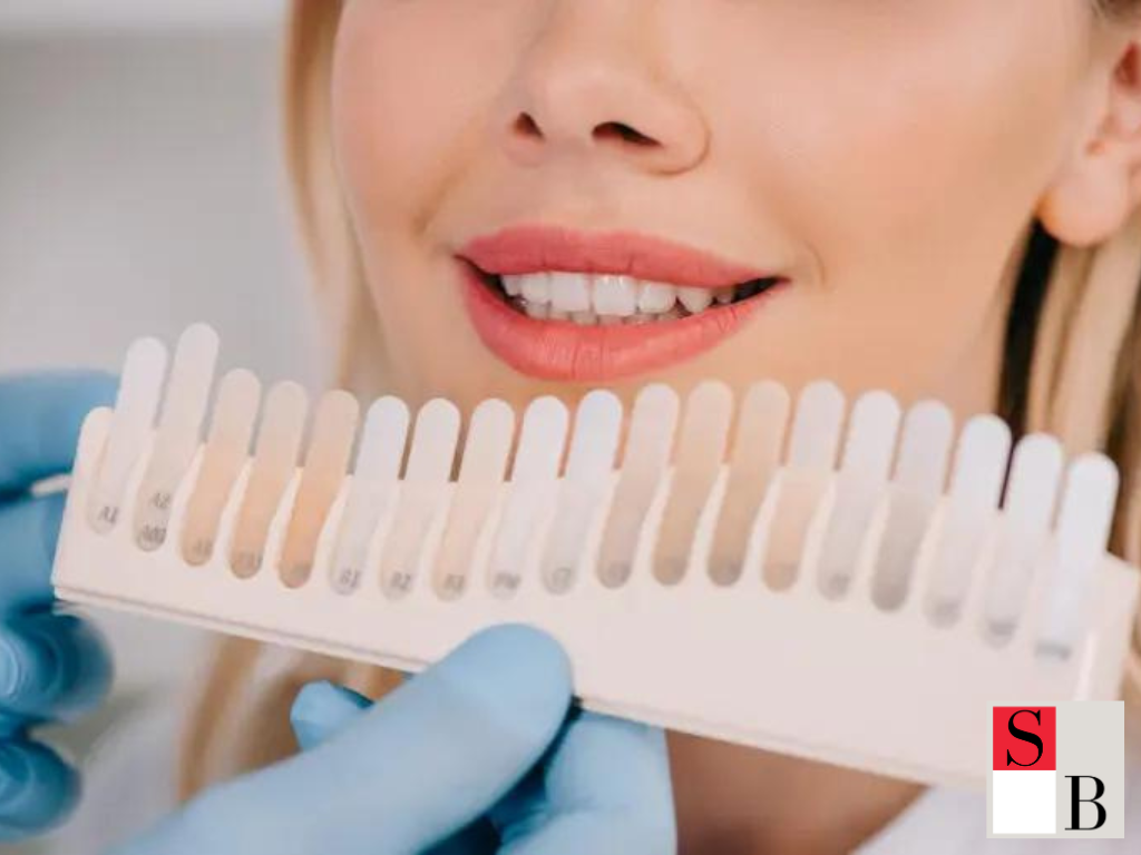 Benefits of Teeth Whitening for Singapore’s Beauty Lifestyle