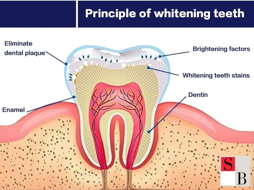 Natural Teeth Whitening