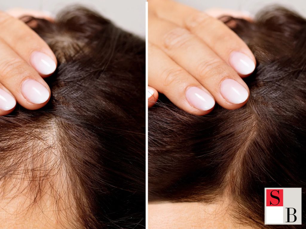 Benefits of Targeted Hair Regrowth Strategies