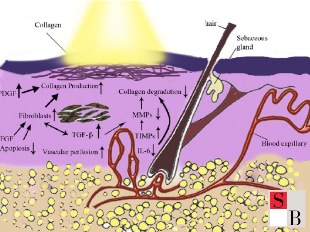 What Is IPL and How It Transforms Skincare in Singapore