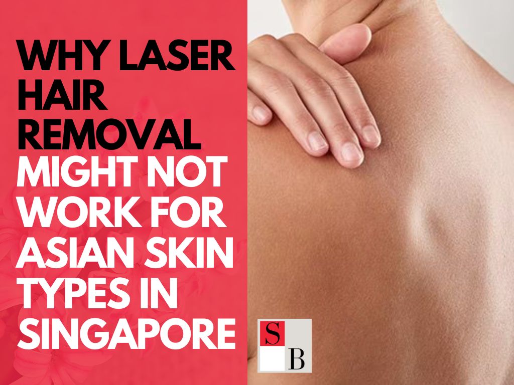 Why Laser Hair Removal Might Not Work for Asian Skin Types in Singapore