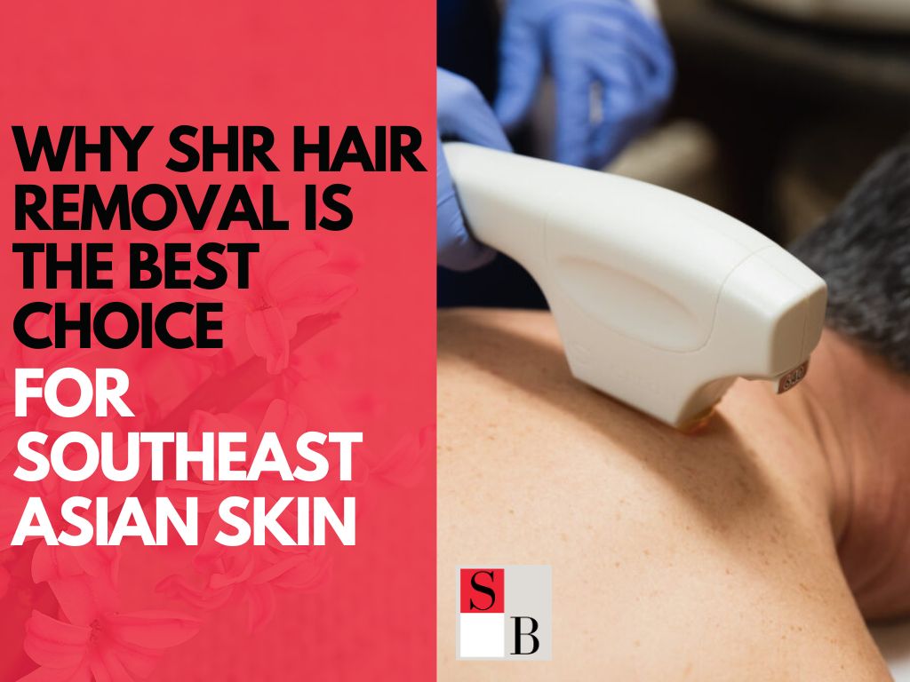Why SHR Hair Removal is the Best Choice for Southeast Asian Skin