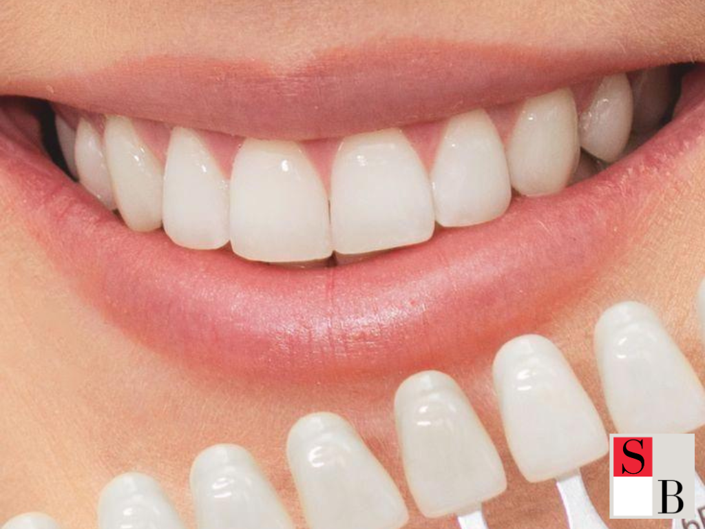 What Causes Coffee Stained Teeth in Singapore