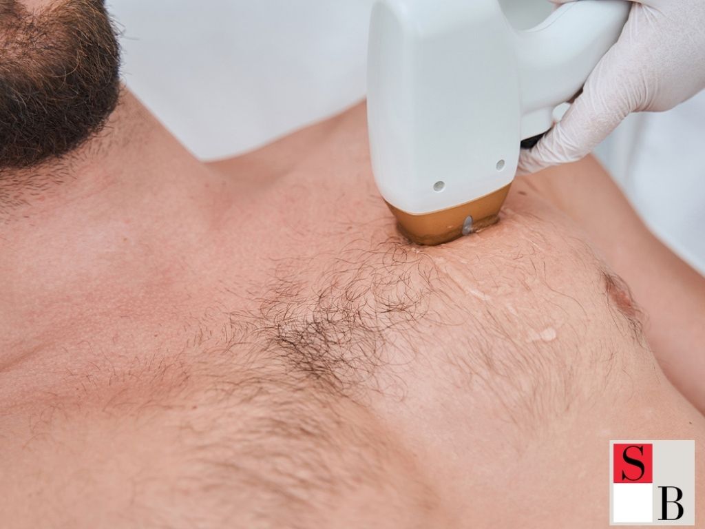 What is SHR Hair Removal and Why It Matters for Singapore
