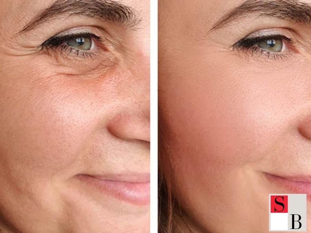 Benefits of Non-Invasive Skincare for Professionals