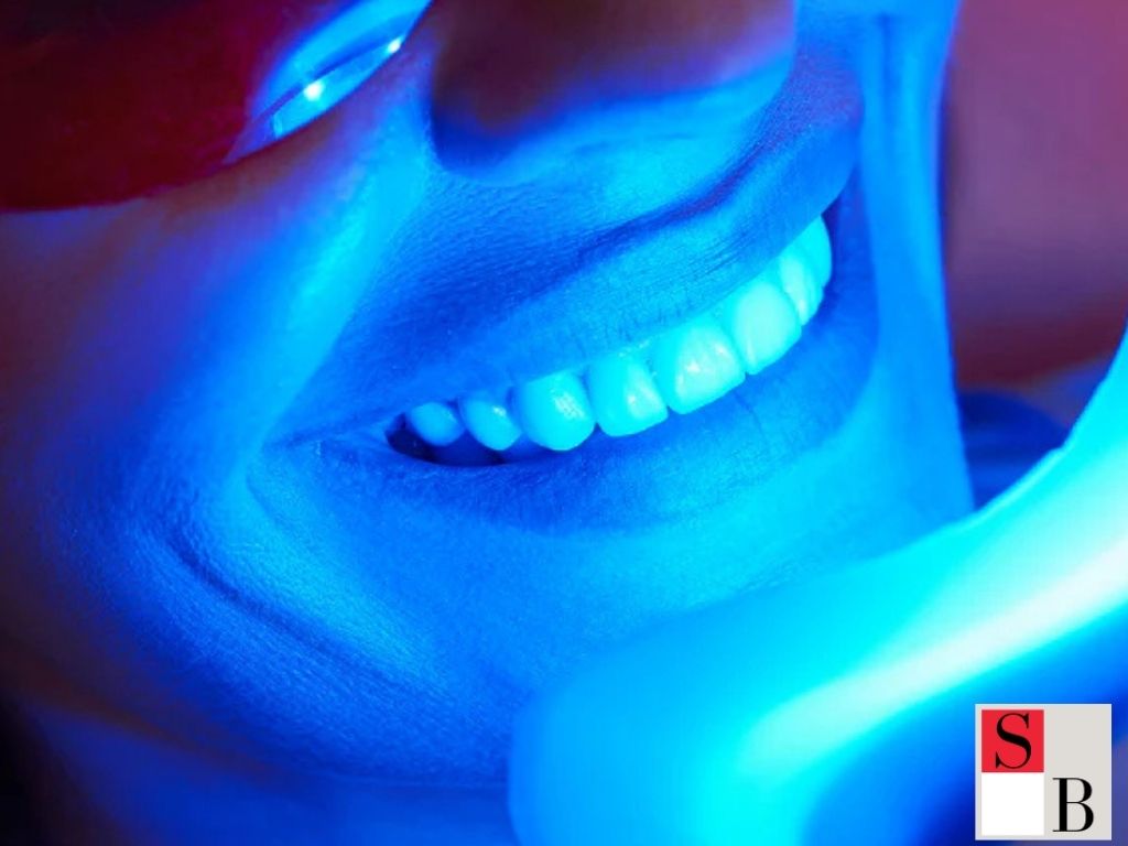 What is LED Teeth Whitening in Singapore?