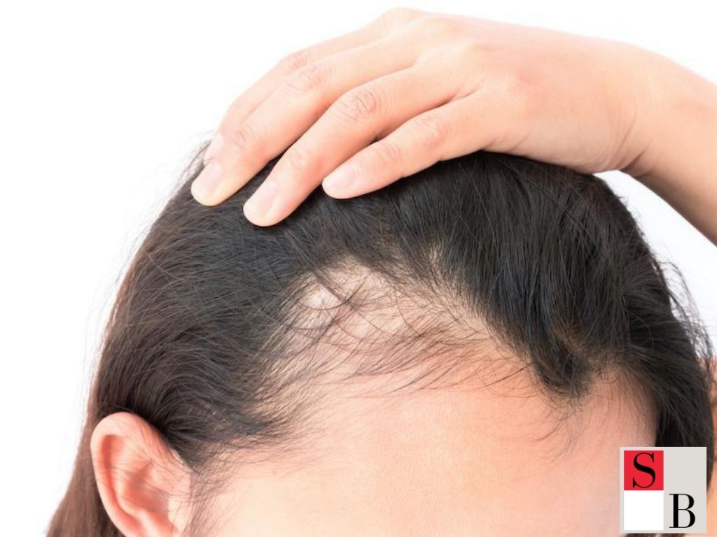 Benefits of Hair Regrowth Strategies for Women