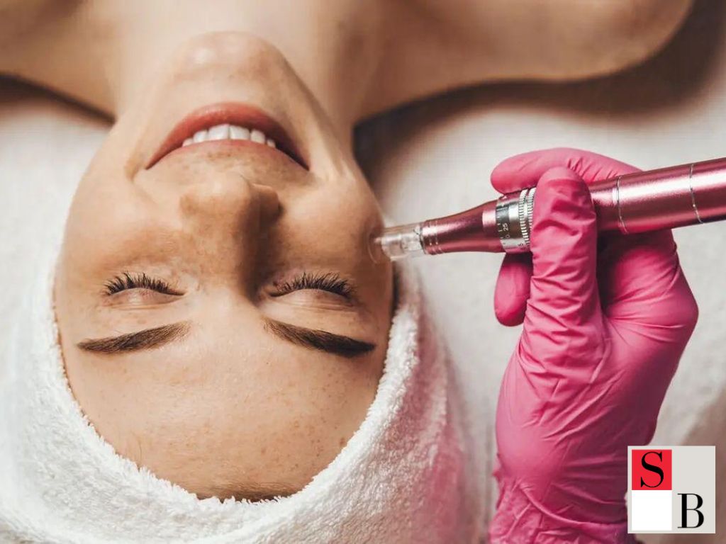 Microneedling Benefits: Why Frequency Matters in Singapore