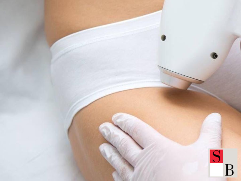 How to Choose the Right Hair Removal Treatment