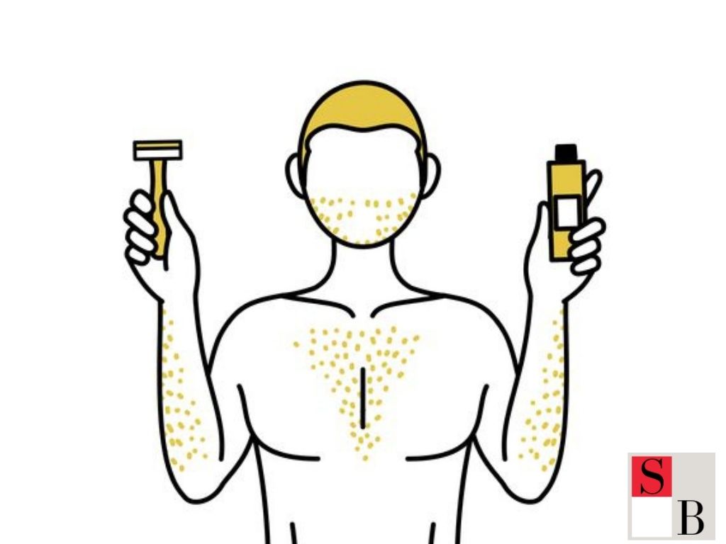 How to Prepare for SHR Hair Removal in Singapore