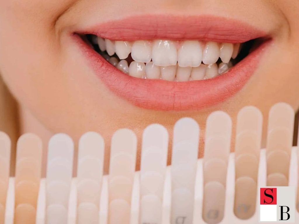 How to Get the Best Results from LED Teeth Whitening in Singapore