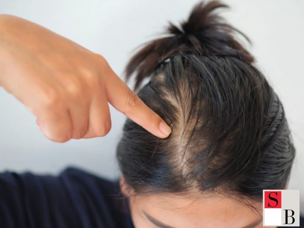 Practical Ways to Manage Hair Thinning After 40 in Singapore