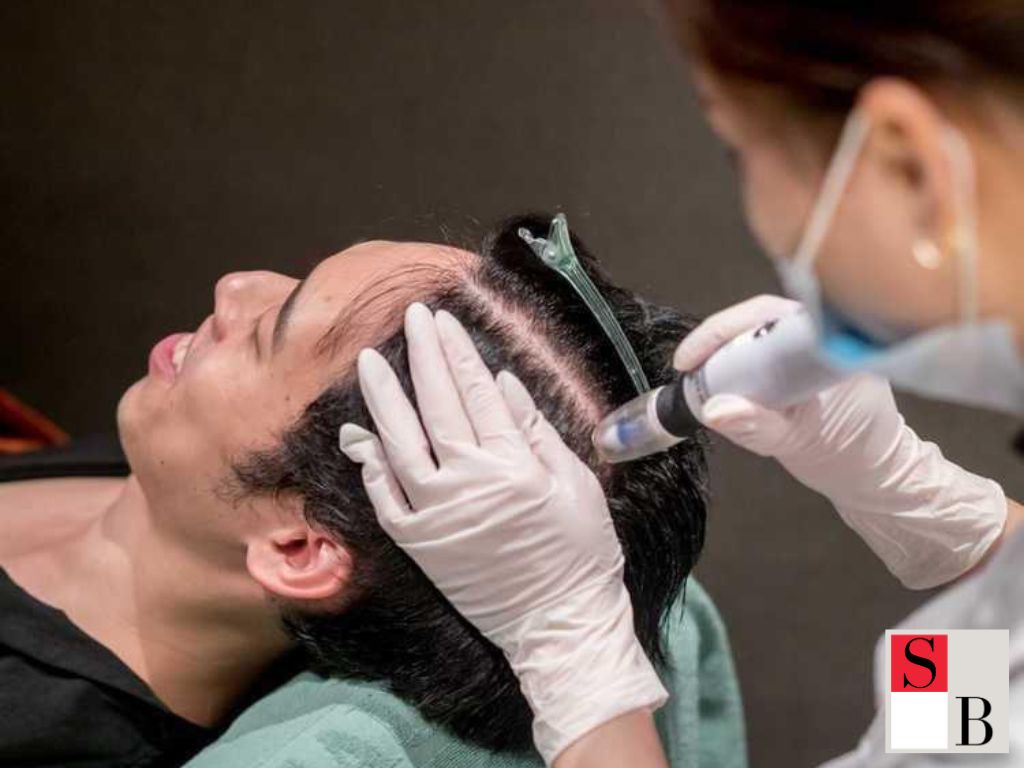 Understanding Hair Regrowth for Busy Executives in Singapore