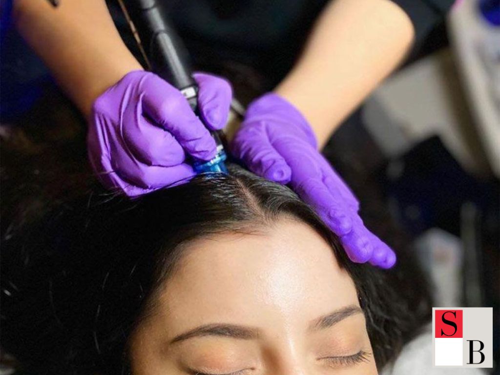 Why Hair Regrowth Strategies Matter for Singapore Executives
