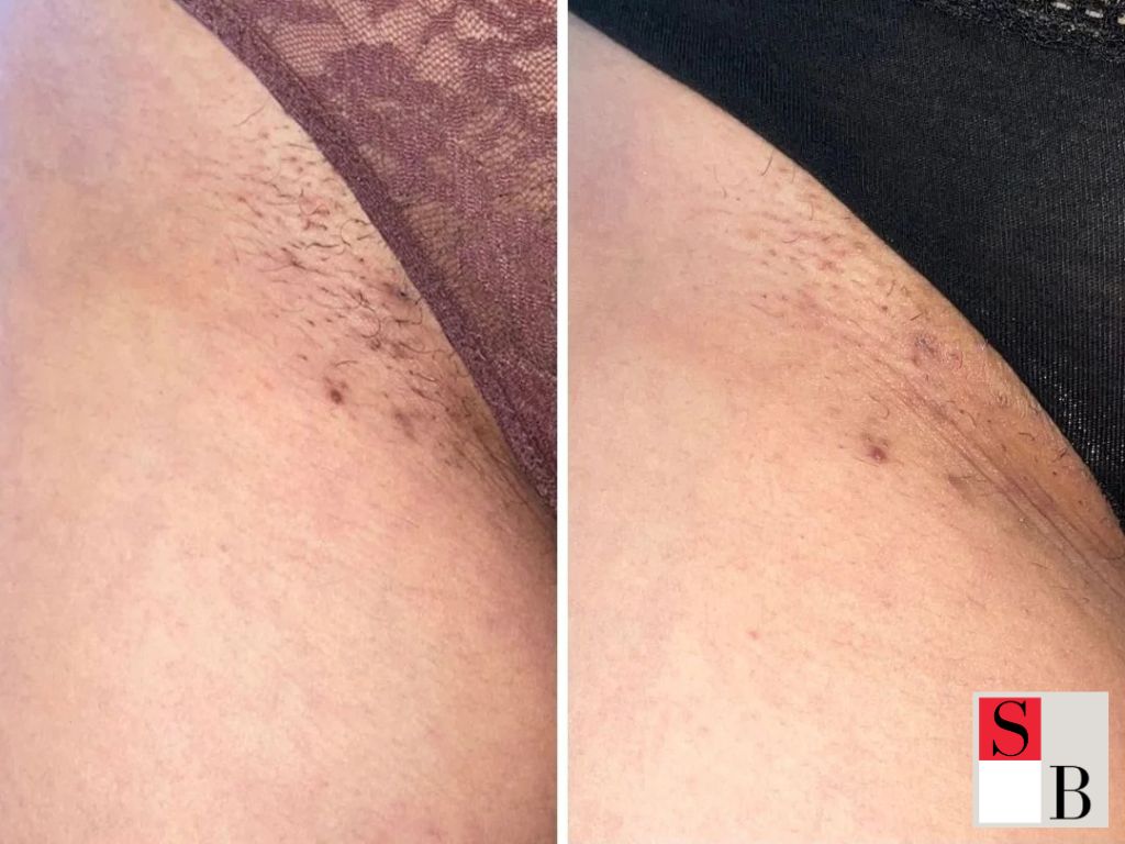 The Benefits of Technology in Intimate Skincare
