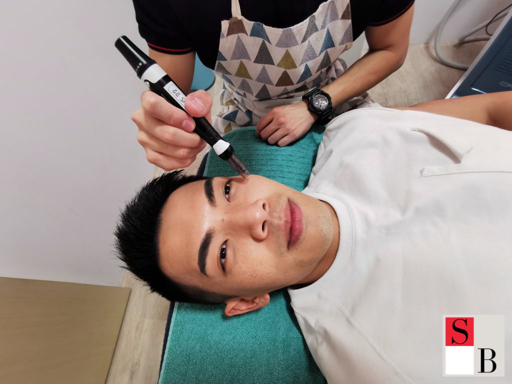 Wellaholic's Professional Microneedling Solutions in Singapore