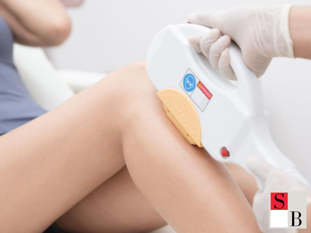 Why Proper Preparation Boosts Laser Hair Removal Results in Singapore
