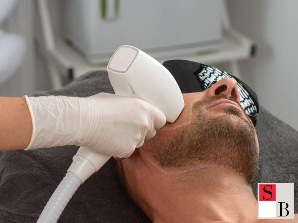Understanding Hair Removal for Men in Singapore