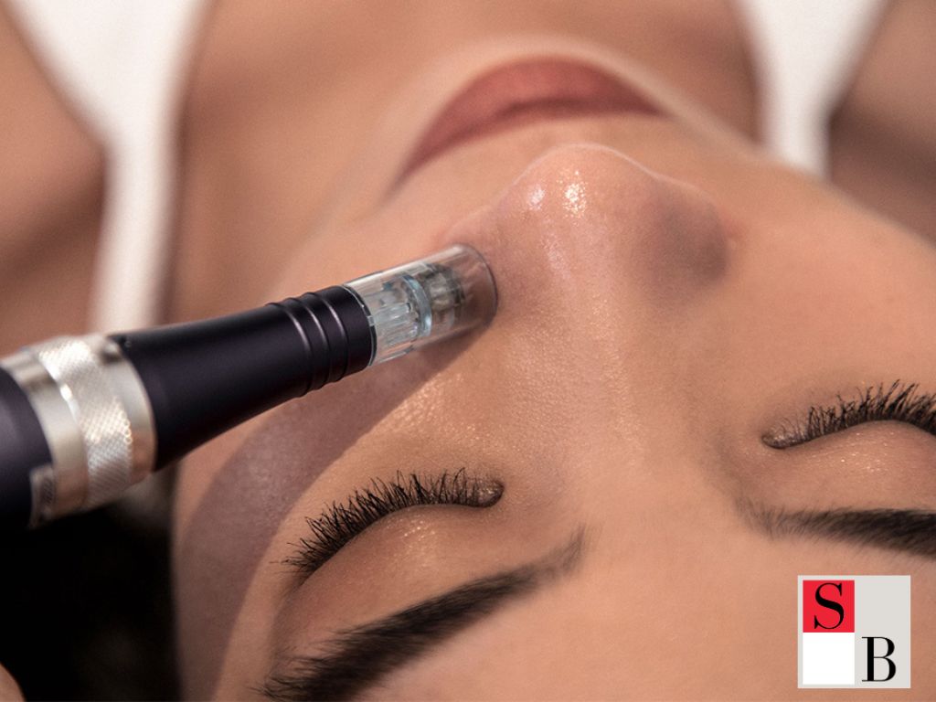 Professional Microneedling Treatments for Acne Scars at Wellaholic Singapore
