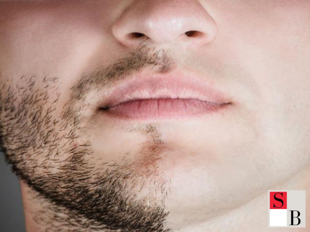 Benefits of Hair Removal for Men in Singapore