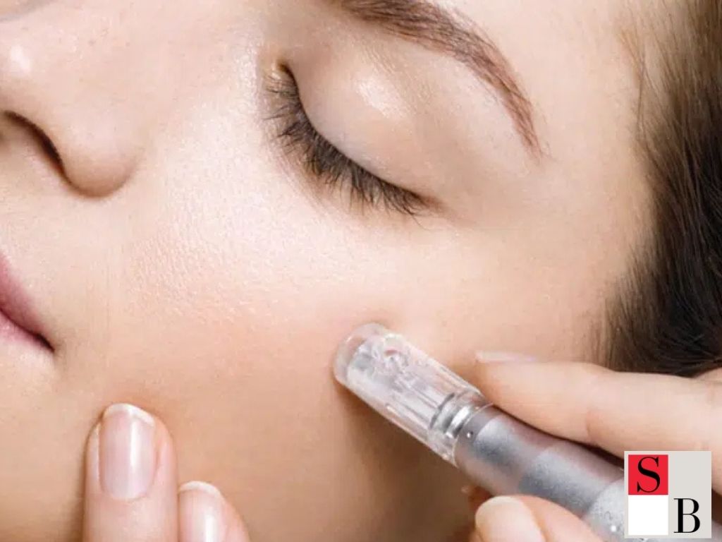 Why Microneedling Recovery is Different in a Tropical Climate