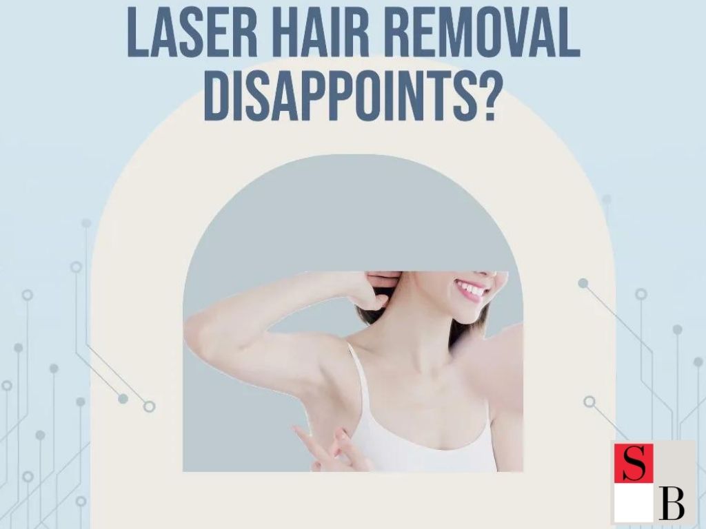 5 Reasons Laser Hair Removal Fails for Southeast Asian Skin