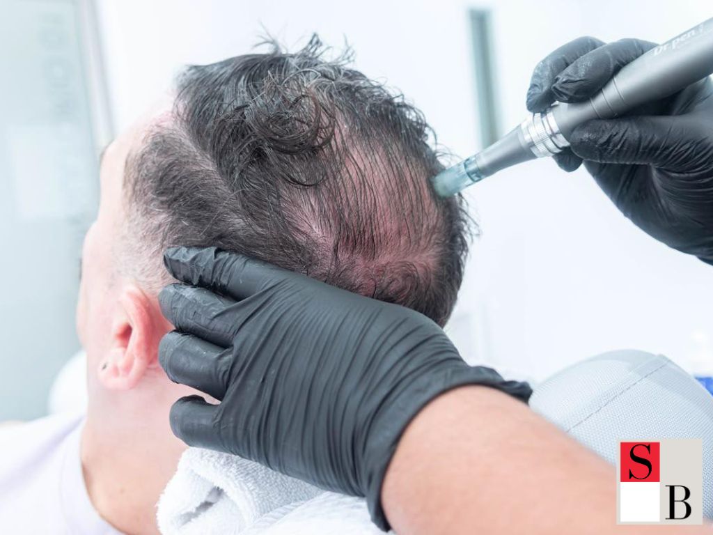 Key Benefits of Hair Growth Treatments in Singapore